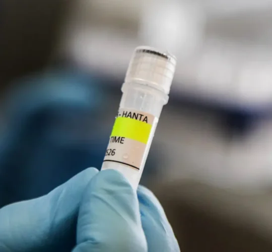 El hantavirus “no se propaga de la misma manera que los coronavirus”, sino que necesita un “contacto cercano e íntimo”