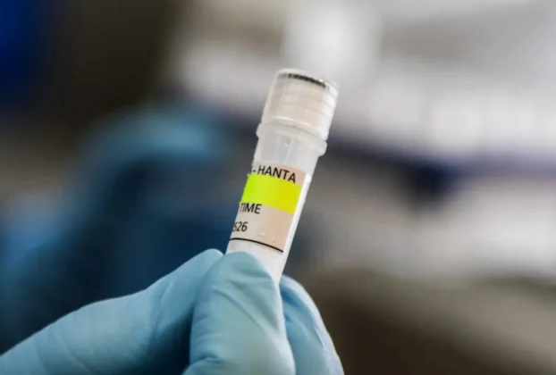 El hantavirus “no se propaga de la misma manera que los coronavirus”, sino que necesita un “contacto cercano e íntimo”