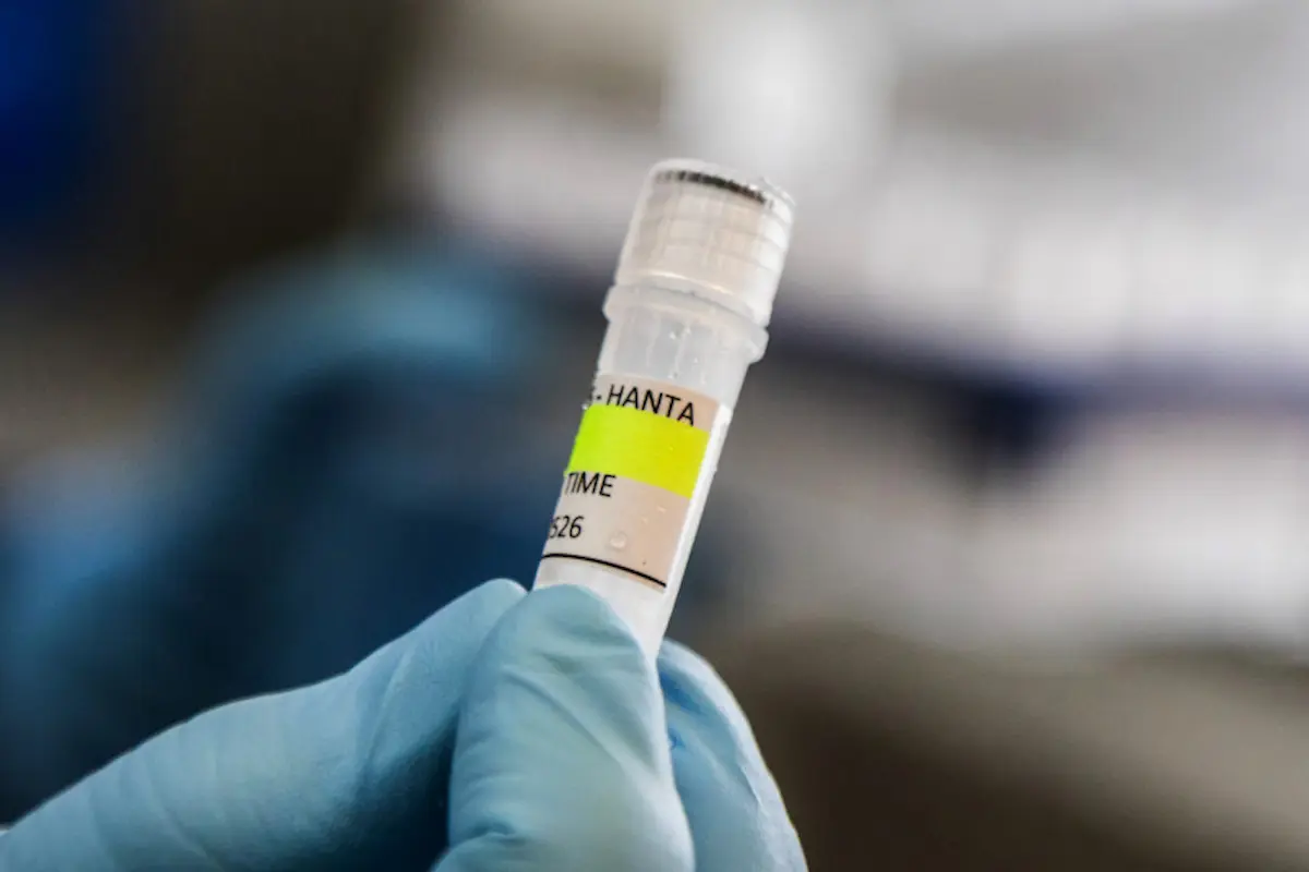 El hantavirus “no se propaga de la misma manera que los coronavirus”, sino que necesita un “contacto cercano e íntimo”